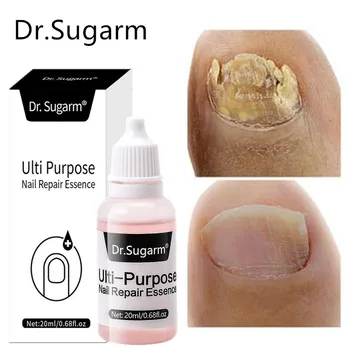 Dr.Sugarm Серум За Лечение на гъбички на ноктите, Грижа За Краката на Лечебното Копър Гел За Премахване на Гъбички на ноктите На Краката Противоинфекционное Средство Кремове 20 мл + 15 г