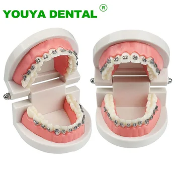 Стоматологичен ортодонтическая модел на зъбите с орто-метална група, подтяжками, проволочно-лигатурными завязками, образователен инструмент за демонстрация на зъболекар